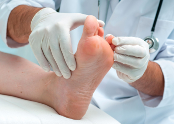 Una herida puede cambiarlo todo: especialistas advierten sobre el riesgo del pie diabético